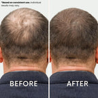 Ledoche | Hairrevive Dual Red Light Therapy Hat