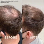 Ledoche | Hairrevive Dual Red Light Therapy Hat