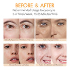 Red Light Therapy for Face, LED Face Mask Light Therapy, 1 Count (Pack of 1)